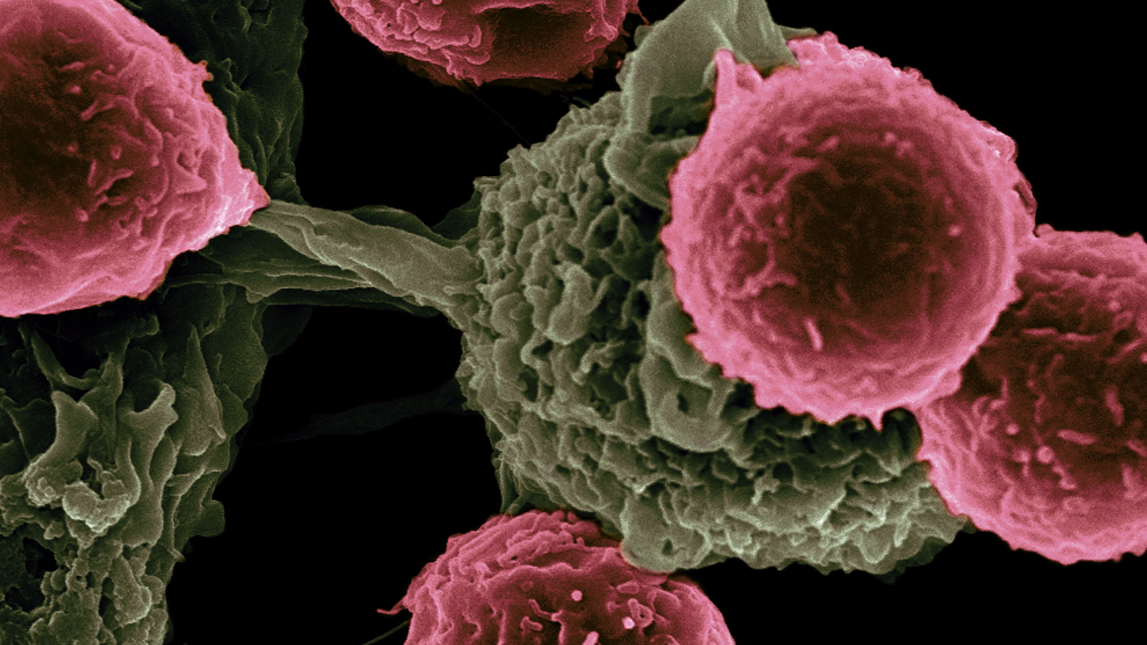 Medical illustration of cancer cells
