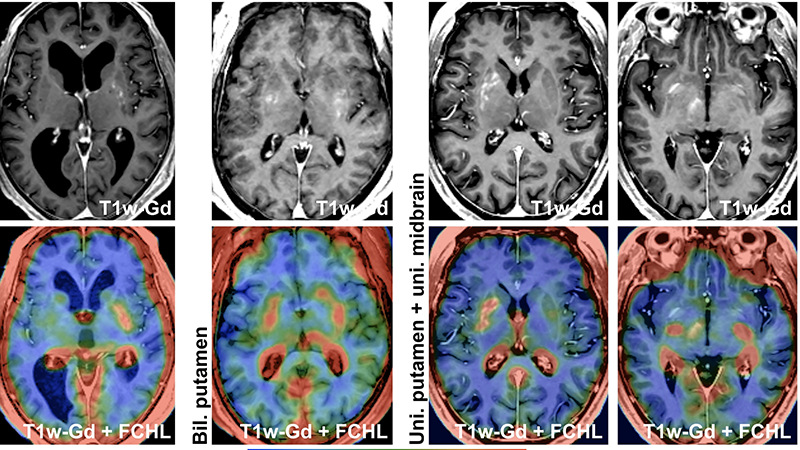 PET imaging of the brain